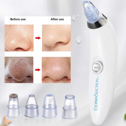 Derma Suction Blackhead Remover divce