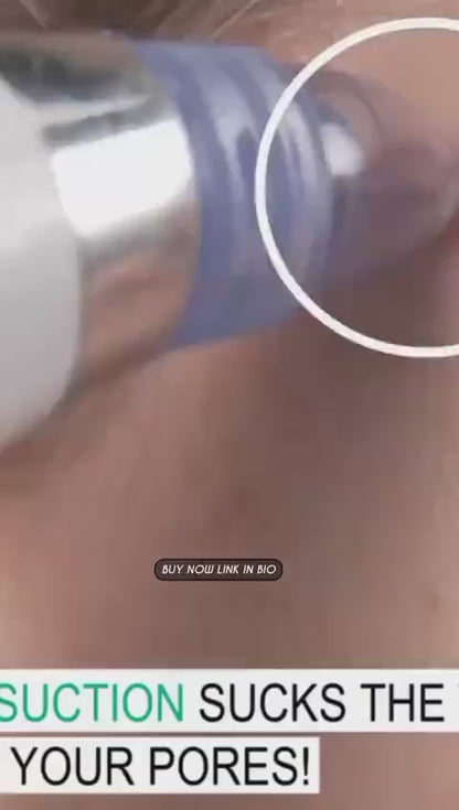 Derma Suction Blackhead Remover divce